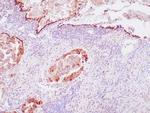 Surfactant Antibody in Immunohistochemistry (Paraffin) (IHC (P))