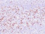 Perforin Antibody in Immunohistochemistry (Paraffin) (IHC (P))