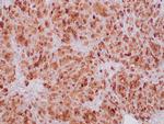 SDHB Antibody in Immunohistochemistry (Paraffin) (IHC (P))