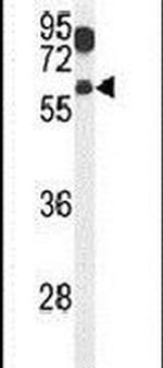 ZACN Antibody in Western Blot (WB)