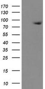 ZBED1 Antibody in Western Blot (WB)