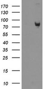 ZBED1 Antibody in Western Blot (WB)