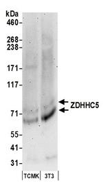 ZDHHC5 Antibody in Western Blot (WB)