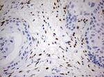 ZEB1 Antibody in Immunohistochemistry (Paraffin) (IHC (P))