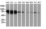 ZFP36 Antibody in Western Blot (WB)