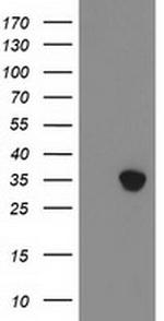 ZFP36 Antibody in Western Blot (WB)