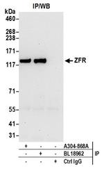 ZFR Antibody in Western Blot (WB)