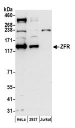 ZFR Antibody in Western Blot (WB)