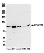 ZFYVE20/Rabenosyn 5 Antibody in Western Blot (WB)