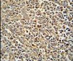 ZNF180 Antibody in Immunohistochemistry (IHC)