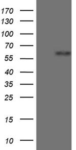 ZNF181 Antibody in Western Blot (WB)