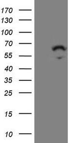 ZNF230 Antibody in Western Blot (WB)