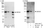 ZNF281 Antibody in Western Blot (WB)