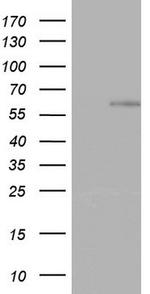 ZNF34 Antibody in Western Blot (WB)