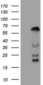 ZNF35 Antibody in Western Blot (WB)