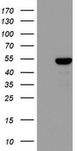 ZNF385B Antibody in Western Blot (WB)