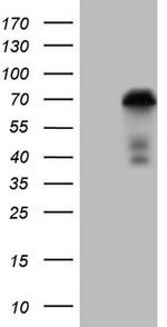 ZNF449 Antibody in Western Blot (WB)