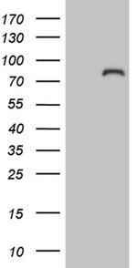 ZNF449 Antibody in Western Blot (WB)