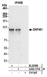 ZNF451 Antibody in Western Blot (WB)