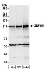 ZNF451 Antibody in Western Blot (WB)