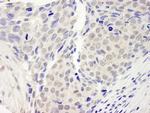 ZNF592 Antibody in Immunohistochemistry (IHC)