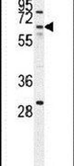 ZNF674 Antibody in Western Blot (WB)