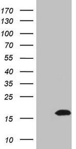 ZNF69 Antibody in Western Blot (WB)