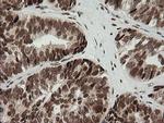 ZSCAN18 Antibody in Immunohistochemistry (Paraffin) (IHC (P))