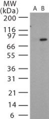 Anthrax Protective Antigen Antibody in Western Blot (WB)