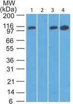 DAAM2 Antibody in Western Blot (WB)