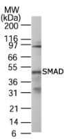 SMAD1/SMAD5/SMAD9 Antibody in Western Blot (WB)