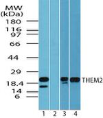 THEM2 Antibody in Western Blot (WB)