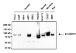 beta Catenin Antibody in Western Blot (WB)