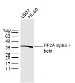 PP2A alpha/beta Antibody in Western Blot (WB)