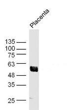 AKT1/3 Antibody in Western Blot (WB)