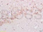 p75 NGF Receptor Antibody in Immunohistochemistry (Paraffin) (IHC (P))