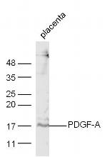 PDGF A Antibody in Western Blot (WB)