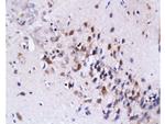 Fas Ligand Antibody in Immunohistochemistry (Paraffin) (IHC (P))