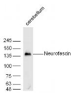 Neurofascin Antibody in Western Blot (WB)