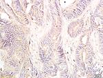 Dnmt3 Beta Antibody in Immunohistochemistry (Paraffin) (IHC (P))