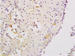 CXCR3 Antibody in Immunohistochemistry (Paraffin) (IHC (P))