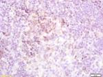 TSHR Antibody in Immunohistochemistry (Paraffin) (IHC (P))