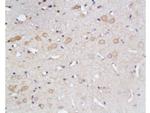 GLUT1 Antibody in Immunohistochemistry (Paraffin) (IHC (P))