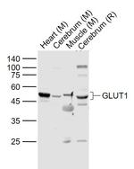 GLUT1 Antibody in Western Blot (WB)