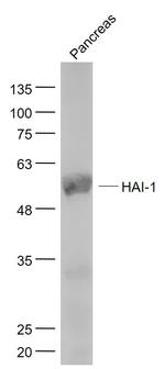 HAI-1 Antibody in Western Blot (WB)