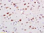 CaMK2 Antibody in Immunohistochemistry (Paraffin) (IHC (P))