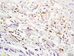 IL2RA Antibody in Immunohistochemistry (Paraffin) (IHC (P))