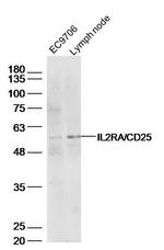 IL2RA Antibody in Western Blot (WB)