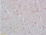 EpCAM Antibody in Immunohistochemistry (Paraffin) (IHC (P))