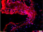 EpCAM Antibody in Immunohistochemistry (Paraffin) (IHC (P))